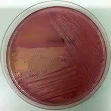 Image result for yersinia fotos