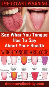 What Your Tongue Can Tell You About Your Health Medical Health Natural Excema Remedies Natural Health Care
