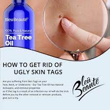 Tea Tree Oil Used For Mole And Skin Tag Removal Walmart Com Essential Oils For Skin Skin Tag Removal Tea Tree Oil