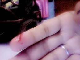 Start by marking tangan berdarah (seri siasat #2) as. Pap Tangan Berdarah Ask Fm Noviaraihan