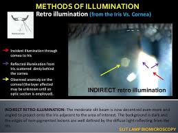 Pin On Ophthalmology