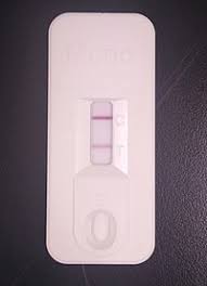 Heterophile Antibody Test Wikipedia