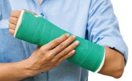 Pada bagian batang tanaman ini memiliki getah berwarna putih yang. Sambung Tulang Patah