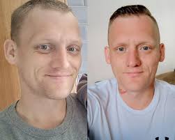 👌💪👏🔗 100 days keep winning champo