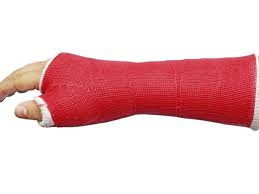 A short arm cast is usually used if a wrist bone is broken. Decorating Ideas To Brighten Your Cast