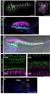 Mutation of SLC7A14 Causes Auditory Neuropathy and Retinitis Pigmentosa  Mediated by Lysosomal Dysfunction