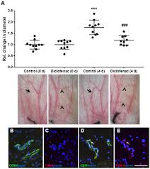If your dose is different, do not change it unless your doctor tells you to do so. Inhibition Of Cyclooxygenase Activity By Diclofenac Attenuates Varicose Remodeling Of Mouse Veins