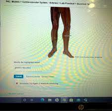 Solved Pal Models Cardiovascular System Arteries Lab Chegg Com