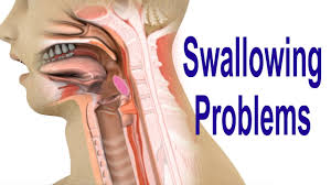 Maybe you would like to learn more about one of these? Causes Of Throat Lump Sensation Globus Youtube