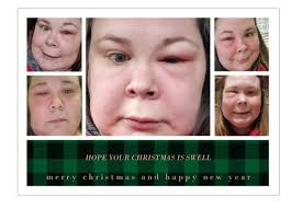 I had pain and pressure in my left sinus for a long time, many doctors no  answer. Finally found an ENT that found cyst & fluid in that sinus. I was  scheduled