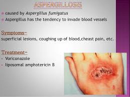 Definition, causes, symptoms, diagnosis and treatment. Aspergillus Fumigatus Symptoms