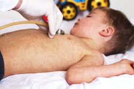 Ecco cosa sapere sulle infezioni da stafilococco nei neonati e nei bambini di età diverse, come individuarle, trattarle e quando chiamare un medico. Sindrome Della Cute Ustionata Cause E Sintomi Vivere Piu Sani