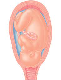 A Guide To The First Stage Of Labor Effacement And Dilation Familyeducation