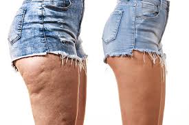 Choose ones with as few simple ingredients as possible. Collagen For Cellulite