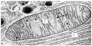 Check spelling or type a new query. The Diagram Below Shows Results Of What Happens To Plant Cell When Placed In A Certain Solution