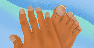 Image result for Clubbing nails feet