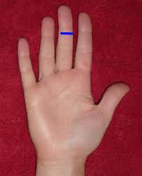 Insertional tendinopathy is a common disorder caused by repetitive tendon strain and subsequent poor tendon healing. Normal Hand Finger Ultrasound How To