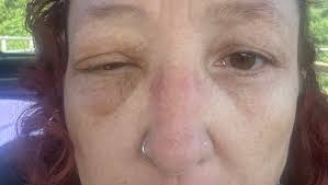 Fundraiser for Heather Maurin by Reanna Maurin : Heather's Medical  Emergency Relief Fund