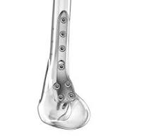 Femoral osteotomy plate - Aplus Biotechnology - distal ...