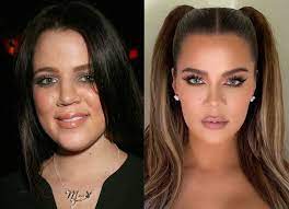 Khloe face evolution reveals negative changes . Khloe Kardashian S Plastic Surgery Secrets Revealed Nz Herald