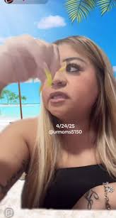 Ashley Trevino Lip Enhancement Reveal