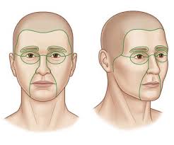 Management of facial burns