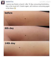 For the j'pan bustup drink, it's also going for $49.90 sgd/20 bottles. Kinohimitsu Collagen 5300mg Review
