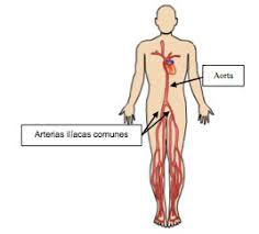 Endovascular Es