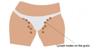 Pin On Bikini Area