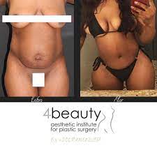 4 Beauty Aesthetics Institute Inc Constantino G Mendieta Md Facs Pagina Inicial Facebook