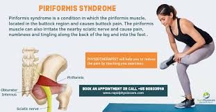 Physio Clinic Singapore Physiotherapy Clinic Lymphatic Drainage Massage Piriformis Muscle