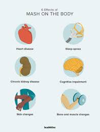 How MASH Affects the Body