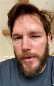 Chris Pratt Reveals Painful Bee Sting
