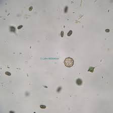 Found in a pond in massachusetts, usa. Microscopy Protozoans Microbus Microscope Educational Website