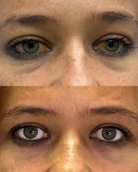 Alan Munn's Instagram, Twitter & Facebook