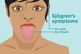 Someone please save me from this see of idiocy. Sjogren S Patients Should Take Steps To Protect Their Heart