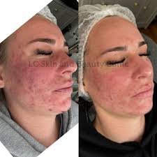 LC Skin & Beauty Clinic（@lc_skinandbeautyclinic）• Instagram 相片與影片