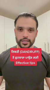 Dingle Berry Dandruff