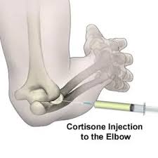 Image result for Elbow Joint Injection