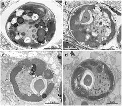 Eukaryotic animal cell electron micrograph. Transmission Electron Micrographs Of Symbiodinium Cells In Animal Download Scientific Diagram
