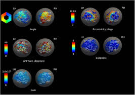Su ling dan yang lainnya menatap para senior cabang barat di panggung tinggi. Simultaneous Estimation Of Population Receptive Field And Hemodynamic Parameters From Single Point Bold Responses Using Metropolis Hastings Sampling Biorxiv