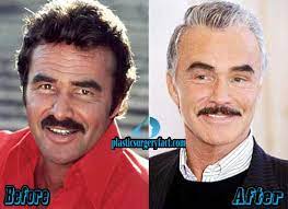 Celebrities have never been afraid to jump on the plastic surgery bandwagon. Burt Reynolds Plastic Surgery Before And After Plastic Surgery Facts