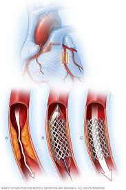 Pin On Health