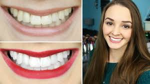 How I Whiten My Teeth