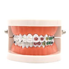 1 Adet Dis Dis Modeli Seramik Braket Metal Arch Tel Ogretim Egitim Dis Modeli Bukkal Tup Ligature Baglari Dis Araclari Dis Model Beyin Aliexpress