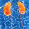 Early renal success refers to renal dysfunction, principally an acute azotemia, that is due to prerenal causes. 1
