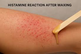 Image result for Histamine