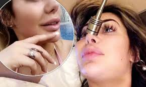See more of chloe ferry on facebook. Chloe Ferry Parades Bruised Pout As She Debuts New Natural Lips After Having Fillers Dissolved Daily Mail Online