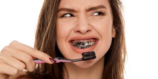Le Dentifrice Au Charbon Est Il Vraiment Un Produit Sur Des Dentistes Vous Expliquent Les Risques Le Huffington Post Life