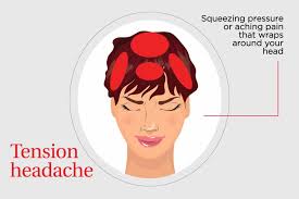 Kepala sering pusing tentunya dapat mengganggu aktivitas. Jenis Sakit Kepala Bisa Berbeda Ini Cara Mengatasinya Theasianparent Indonesia